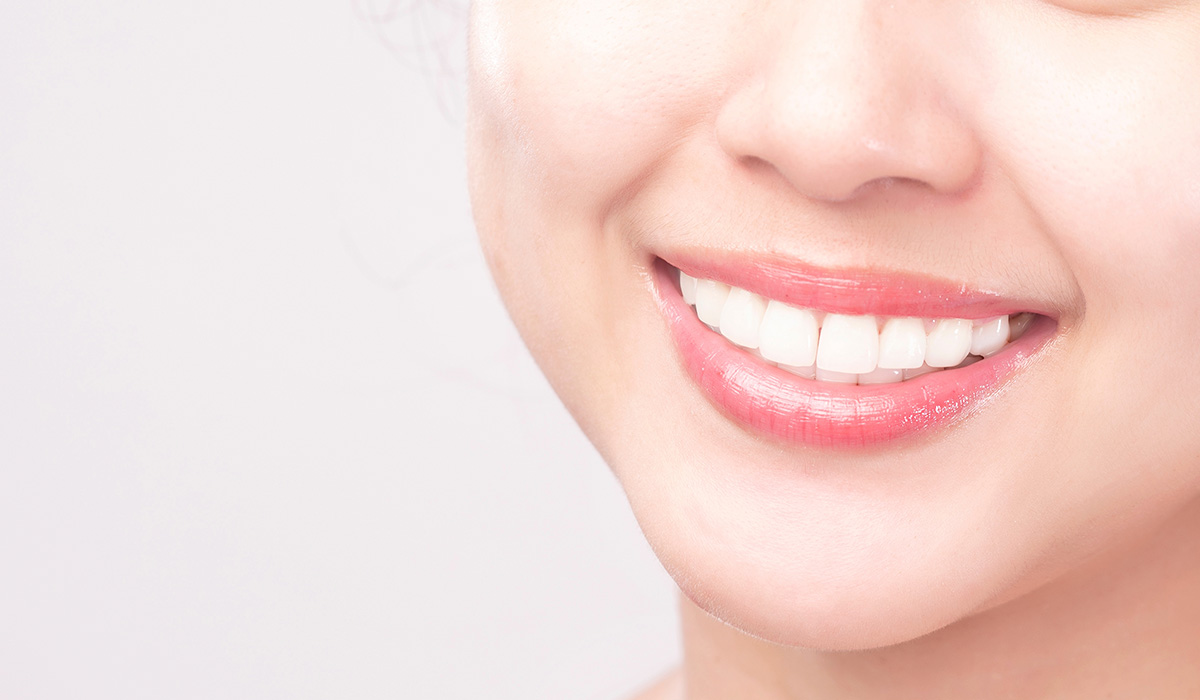 blanqueamiento dental
